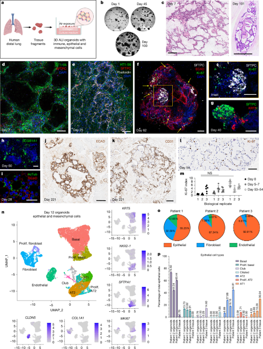 Figure from the lung organoid study showing immune cell populations preserved in a three-dimensional lung tissue model