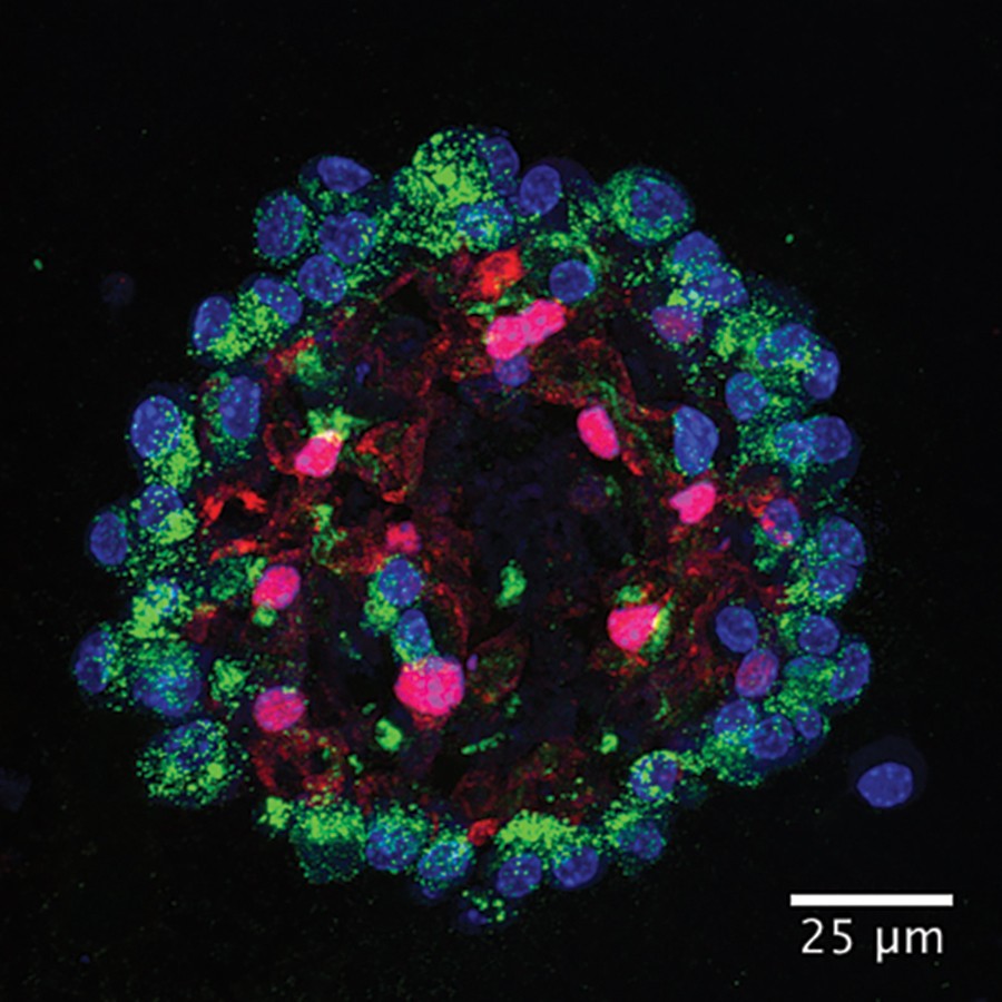 Microscopy image of a human distal lung organoid grown for respiratory research